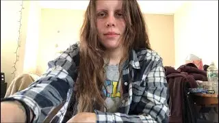 ONE YEAR Dupixent Update! (Atopic Dermatitis, Septoplasty)