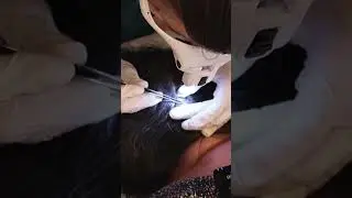 ASMR School Nurse LICE Check on 3 Students but 2 INFESTED #asmr #short #shorts