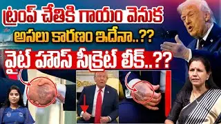 Trump Hand Injury News : ట్రంప్ చేతికి గాయం వెనుక వైట్ హౌస్ సీక్రెట్ లీక్..?? | Wild Wolf Telugu