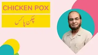 Chickenpox | AWARENESS | Sehat A - Z