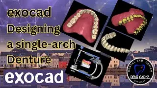 exocad Designing a single arch denture