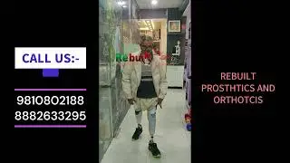 BELOW KNEE prosthetics #life #artificiallimb #delhi #mobility #video #duet #india #happiness