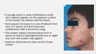 Lecture-149: Perforating Dermatoses. Rook's Chapter 96.