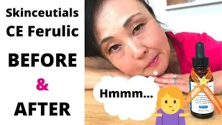 SkinceuticalsCE Ferulic: стоит ли оно того? До и после