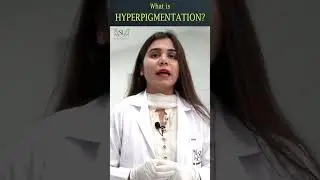 What does hyperpigmentation look like | Dr Shaista Lodhi Aesthetic clinic