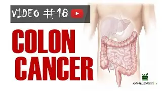 COLON CANCER and NATURAL WAYS TO TREAT IT