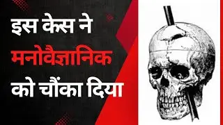 Phineas Gage  case Study  Explained in hindi by Dinesh Gupta Mindset Guru एक अनोखा केस |The iron rod
