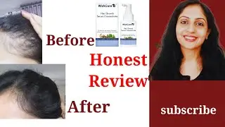 How I Stopped My Hairfall- how I regrow my my hair- 2X stronger solution for all hair problems