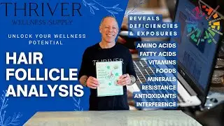 Hair Follicle Analysis - The Ultimate Wellness Tool