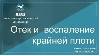 307  Отек и воспаление крайней плоти