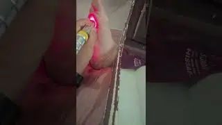 Laser therapy🤫🤫#shortsvideo #laser #doctor #physiotherapy #health #painrelief #drwell#pt #motivation