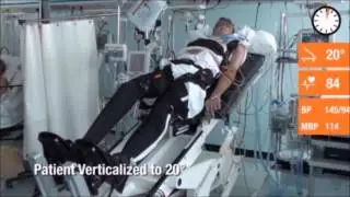 Effectiveness of a Very Early Stepping Verticalization Protocol in Severe Acquired Brain Injured