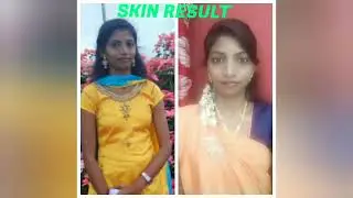 weight gain !!#weightgain 💪 😌 #easyweightloss
