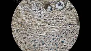 Chicken bone between crossed polarizers (01)
