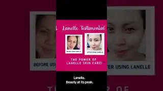 See these amazing Lanelle Skin Care results! #viral #trending #shortsviral