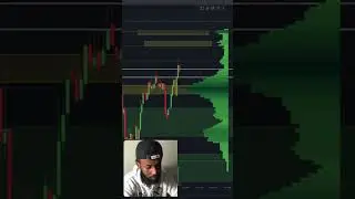 Day Trading options Live. Using 1 indicator! #technicalindicators