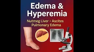 Pathology Lecture 9 | Hemodynamic Disorders: Edema & Hyperemia | Nutmeg Liver | BHMS &bull; MBBS &bull; BAMS
