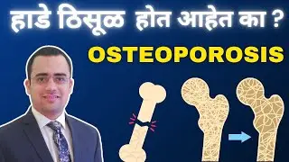 Osteoporosis Explained: Early Signs, Who&rsquo;s at Risk, and How to Protect Your Bones | Dr Akhil Tiwari