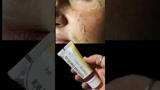 Glyco 6 cream Glycolic Acid 6% cream remove pigmentation|Dark spots|Acne scars