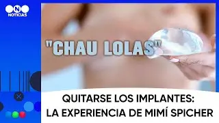 Quitarse los implantes: la experiencia de Mim&iacute; Spicher