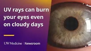 UV rays can burn your eyes even on cloudy days