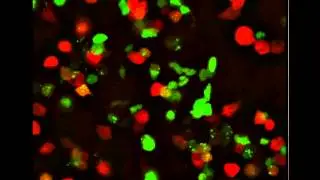 Cytoplasmic RNA Granules and Viral Infection: Video 1