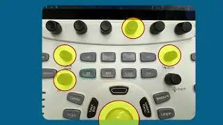 GE VividE95 3D Knobology