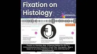 Fixation on Histology: Enhanced Method for PGP 9.5 Immunohistochemical Labeling-Sm Fiber Neuropathy