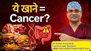 कौन-कौन से खाने से कोलोरेक्टल कैंसर होता है? | Colon Cancer Foods to Avoid | Surgeon Advice