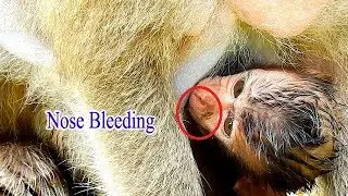 Nose Bleeding Poor Baby Daniela After Dolly Kidnapper | Million Worry Baby Life In Ameri Group