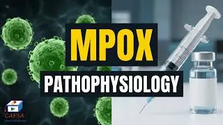 Mpox (Monkeypox) Virus: Symptoms, Pathophysiology, Prevention & Treatment