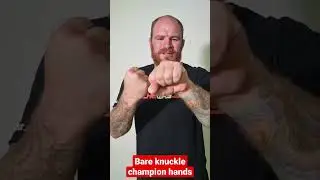 Bare Knuckle Boxers hands! #fighting  #bareknuckleboxing #ufc