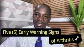 Signs and Symptoms of Arthritis