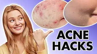 Acne Hacks: Transform Your Skin is About to Change with Red Light Therapy! 🚨 #rxmoore #lighttherapy