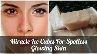 MIRACLE ICE CUBES FOR SPOTLESS GLOWING SKIN/POTATO TOMATO /SKIN CARE/HOME REMEDIES & TIPS
