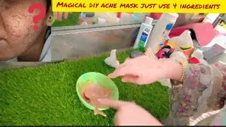 &ldquo;DIY Acne Face Mask | Clear Skin Remedy&rdquo;#diyfacemask #homesalon 