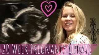 20 WEEK PREGNANCY UPDATE // BUMP SHOT