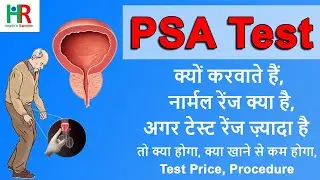 PSA ( prostate specific antigen ) test in hindi | PSA test normal range | What is PSA test,