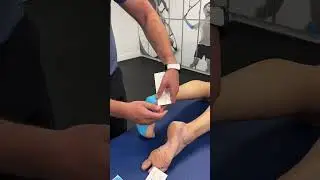 Taping for plantar fasciitis with Spidertech i-Strips