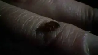 Don't Let The  BedBugs Bite