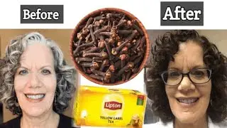 &ldquo;STOP Gray Hair Naturally! Cloves, Coffee & Black Tea DIY Hair Remedy&rdquo;