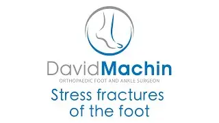 Stress fractures of the foot