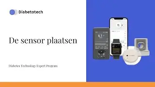 Dexcom ONE Plus | Установка сенсора | Diabetotech