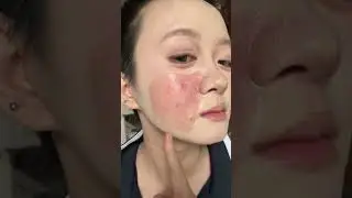 Kem nền che khuyết điểm đỉnh cao. Da đỏ, mụn bọc vi&ecirc;m cũng che được hết. Mỏng nhẹ, mịn mướt, gi&aacute; rẻ