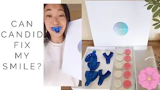 CANDID CLEAR ALIGNERS (Starter Kit Unboxing & Process)