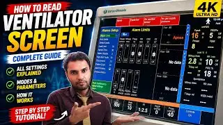 What does Ventilator for patient Screen shows in Hindi 🔥4K Video | Understand every number of ICU...