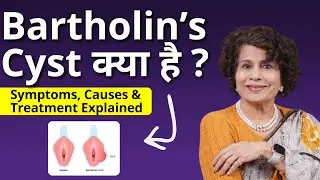 What is a Bartholin's Cyst? Symptoms, Causes & Treatment Explained