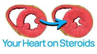 Your Heart on Steroids: Keeping Safe in Bodybuilding