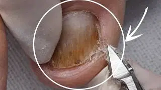 Satisfying Deep Toenail Cleaning | Relaxing Pedicure No Talking