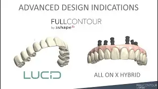 How to Differentiate Your Lab with Advanced Aesthetics